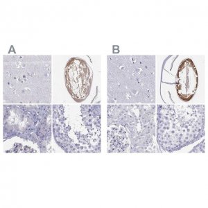 Anti-GJA8 antibody produced in rabbit 