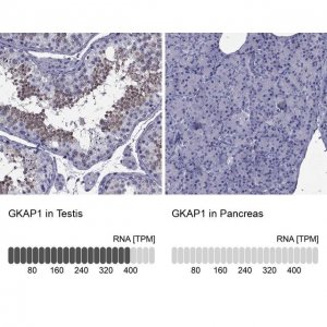 Anti-GKAP1 