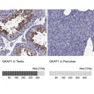Anti-GKAP1 antibody produced in rabbit 