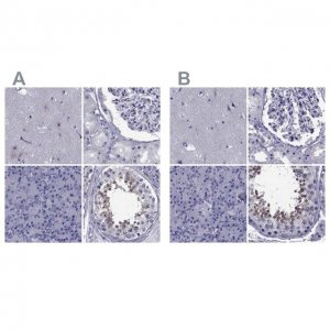 Anti-GKAP1 antibody produced in rabbit 