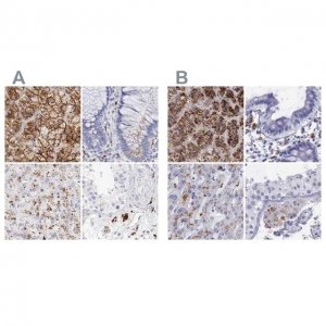 Anti-GLA antibody produced in rabbit 