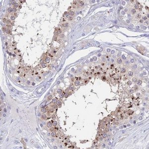 Anti-GLB1L antibody produced in rabbit 