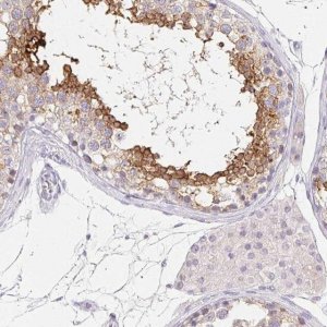Anti-GLIPR1L1 antibody produced in rabbit 
