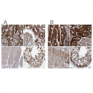 Anti-GLOD4 antibody produced in rabbit HPA021623-100UL