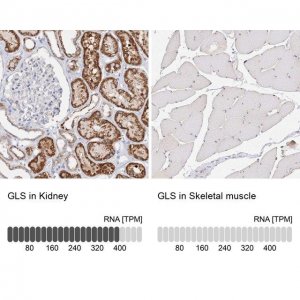 Anti-GLS antibody produced in rabbit HPA036223-100UL