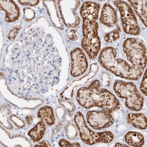 Anti-GLS antibody produced in rabbit HPA036223-100UL