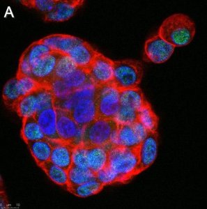 Anti-GLS2 Antibody, clone 3G12 ZooMAb Rabbit Monoclonal 