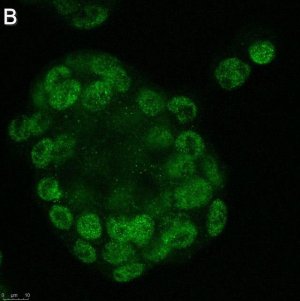 Anti-GLS2 Antibody, clone 3G12 ZooMAb Rabbit Monoclonal 