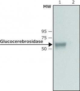 Anti-Glucocerebrosidase antibody produced in rabbit 