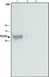 Anti-Glucocerebrosidase antibody produced in rabbit 