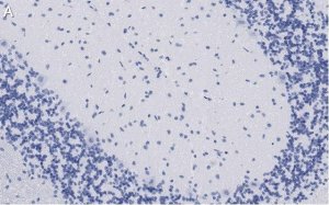 Anti-GluR1 Antibody, clone 1C11, ZooMAb Rabbit Monoclonal 