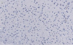 Anti-GluR1 Antibody, clone RH95 ZooMAb Mouse Monoclonal 
