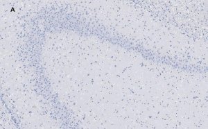 Anti-GluR2 Antibody, clone 1K4, ZooMAb Rabbit Monoclonal 