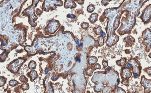 Anti-GLUT-1 Antibody, CT, clone 16D21, ZooMAb Rabbit Monoclonal 