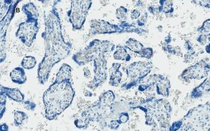 Anti-GLUT-1 Antibody, CT, clone 16D21, ZooMAb Rabbit Monoclonal 