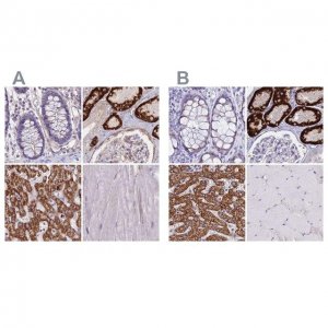 Anti-GLYAT antibody produced in rabbit HPA040251-100UL