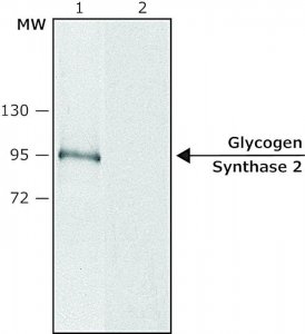 Anti-Glycogen Synthase 2 (C-terminal) antibody produced in rabbit SAB4200295-200UL
