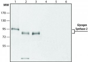 Anti-Glycogen Synthase 2 (C-terminal) antibody produced in rabbit SAB4200295-200UL