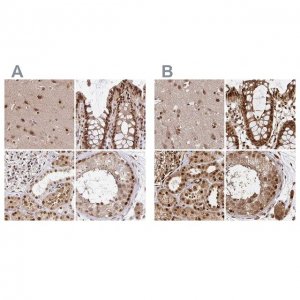 Anti-GLYR1 antibody produced in rabbit 