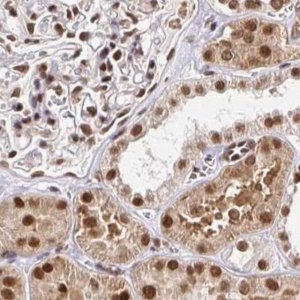 Anti-GLYR1 antibody produced in rabbit 