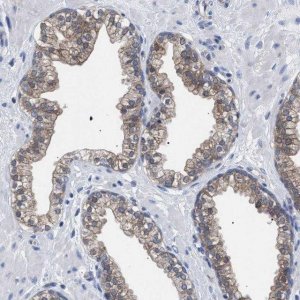 Anti-GMPR antibody produced in rabbit 