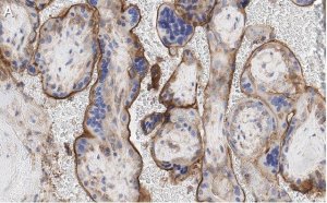 Anti-GNA-11 (G alpha 11) Antibody, clone 1F16 ZooMAb Rabbit Monoclonal 