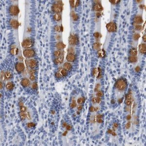 Anti-GNAS antibody produced in rabbit 
