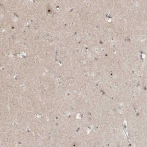 Anti-GNL3L antibody produced in rabbit 