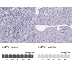 Anti-GNLY antibody produced in rabbit 