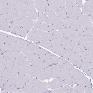 Anti-GNLY antibody produced in rabbit 