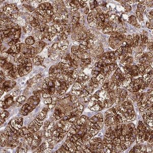Anti-GNS antibody produced in rabbit 