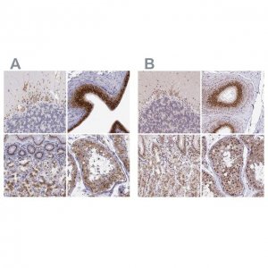 Anti-GOLGA5 antibody produced in rabbit 