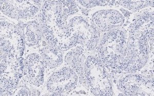 Anti-Golgin-97 Antibody, clone 4K16, ZooMAb Rabbit Monoclonal 
