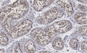 Anti-Golgin-97 Antibody, clone 4K16, ZooMAb Rabbit Monoclonal 