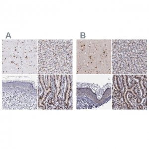 Anti-GOLIM4 antibody produced in rabbit 