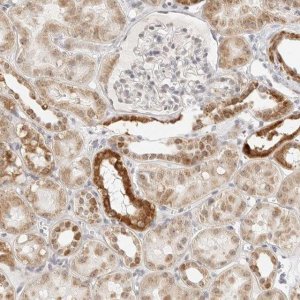 Anti-GORAB antibody produced in rabbit 