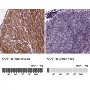 Anti-GOT1 antibody produced in rabbit HPA072629-100UL