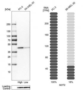 Anti-GOT2 antibody produced in rabbit 