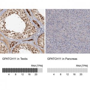 Anti-GPATCH11 antibody produced in rabbit 