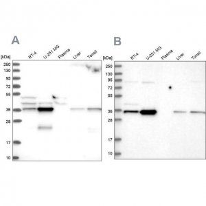 Anti-GPATCH11 antibody produced in rabbit 