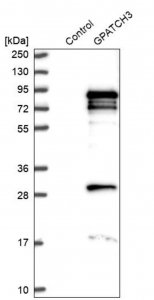 Anti-GPATCH3 antibody produced in rabbit 
