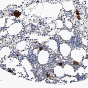 Anti-GPATCH3 antibody produced in rabbit 