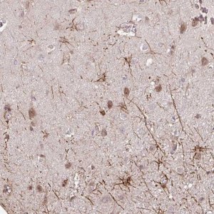 Anti-GPC5 antibody produced in rabbit 