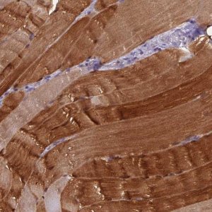Anti-GPD1 antibody produced in rabbit HPA044620-100UL