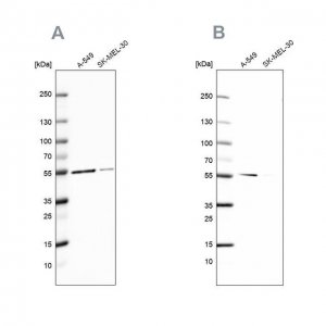 Anti-GPI antibody produced in rabbit 