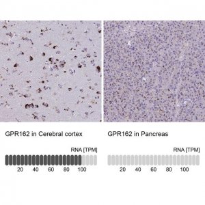 Anti-GPR162 antibody produced in rabbit HPA055135-100UL