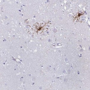Anti-GPR17 antibody produced in rabbit 