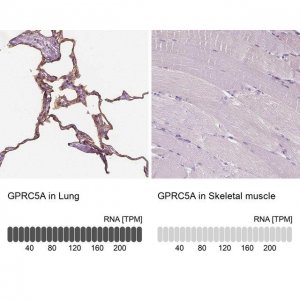Anti-GPRC5A antibody produced in rabbit 