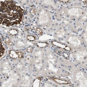 Anti-GPRC5B antibody produced in rabbit 