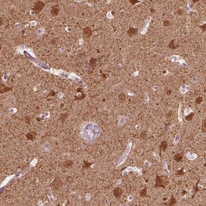 Anti-GPRIN1 antibody produced in rabbit 